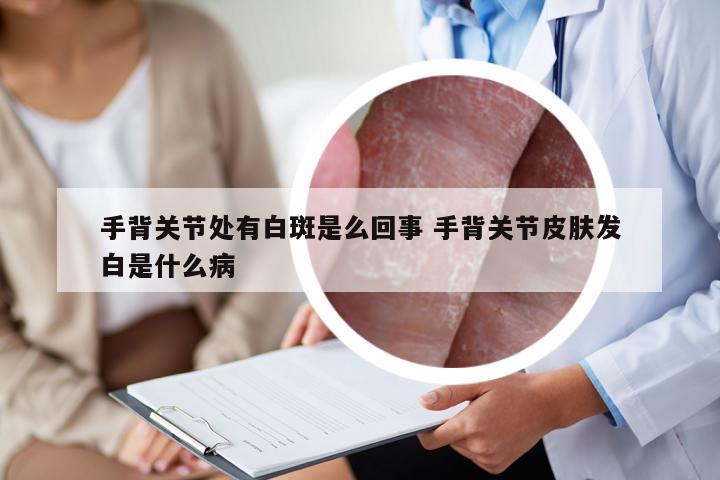 手背关节处有白斑是么回事 手背关节皮肤发白是什么病