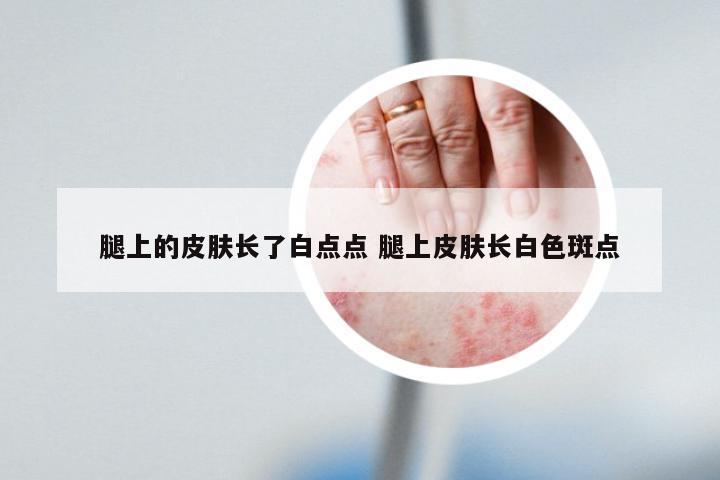 腿上的皮肤长了白点点 腿上皮肤长白色斑点