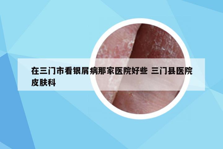 在三门市看银屑病那家医院好些 三门县医院皮肤科