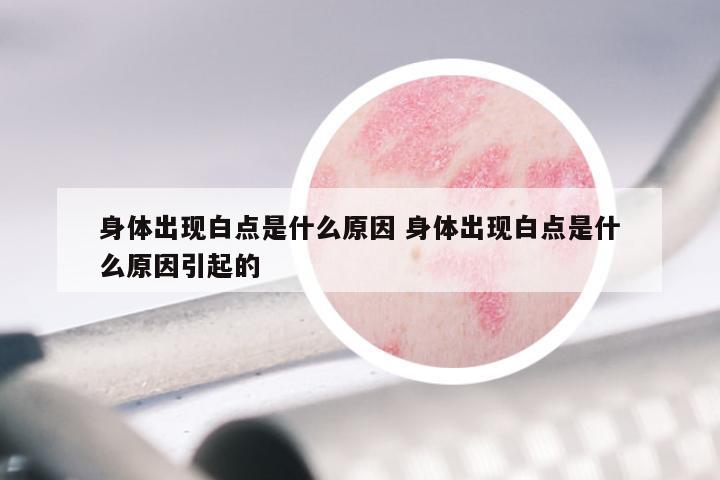 身体出现白点是什么原因 身体出现白点是什么原因引起的