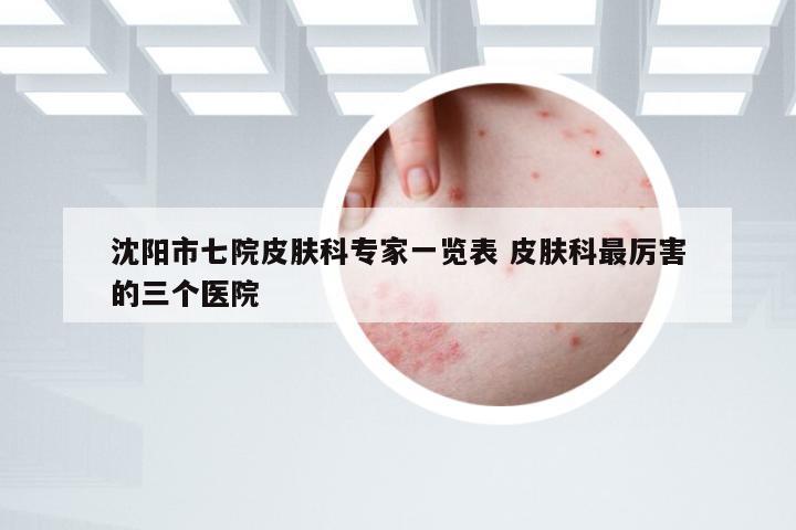 沈阳市七院皮肤科专家一览表 皮肤科最厉害的三个医院