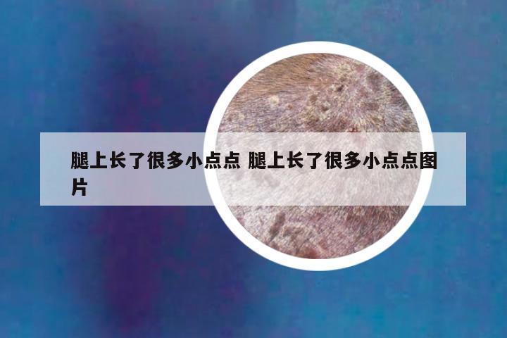 腿上长了很多小点点 腿上长了很多小点点图片