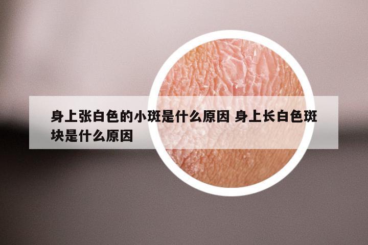 身上张白色的小斑是什么原因 身上长白色斑块是什么原因