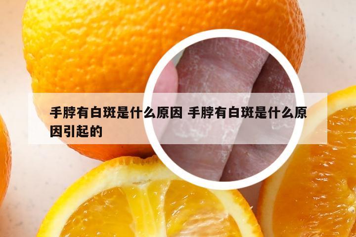 手脖有白斑是什么原因 手脖有白斑是什么原因引起的