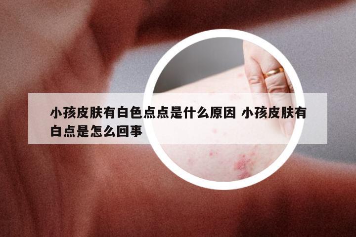 小孩皮肤有白色点点是什么原因 小孩皮肤有白点是怎么回事