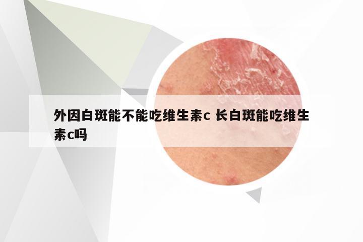 外因白斑能不能吃维生素c 长白斑能吃维生素c吗
