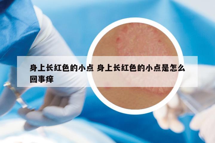 身上长红色的小点 身上长红色的小点是怎么回事痒