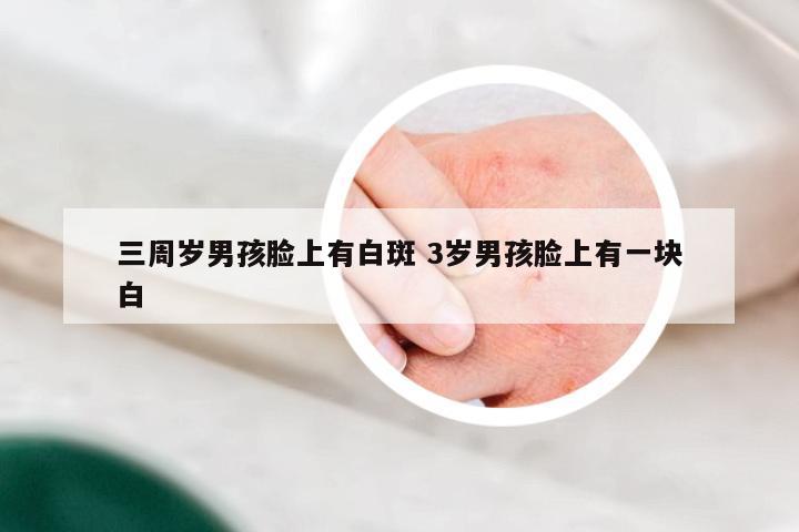 三周岁男孩脸上有白斑 3岁男孩脸上有一块白
