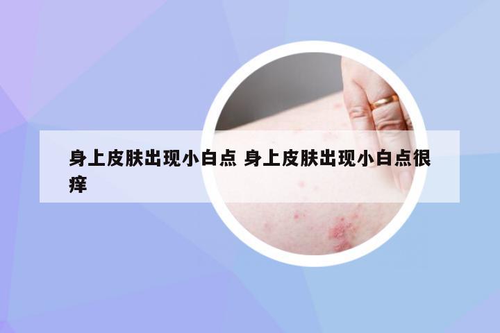 身上皮肤出现小白点 身上皮肤出现小白点很痒