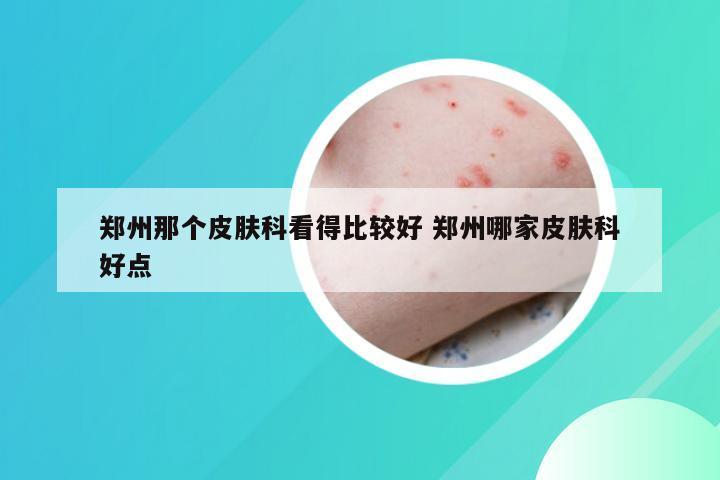 郑州那个皮肤科看得比较好 郑州哪家皮肤科好点
