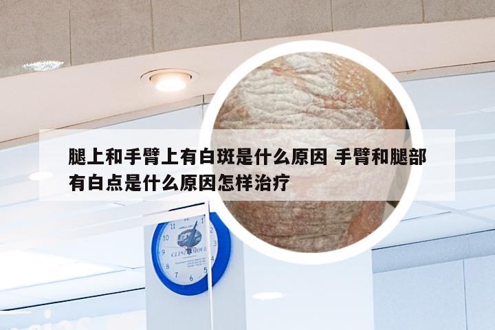 腿上和手臂上有白斑是什么原因 手臂和腿部有白点是什么原因怎样治疗