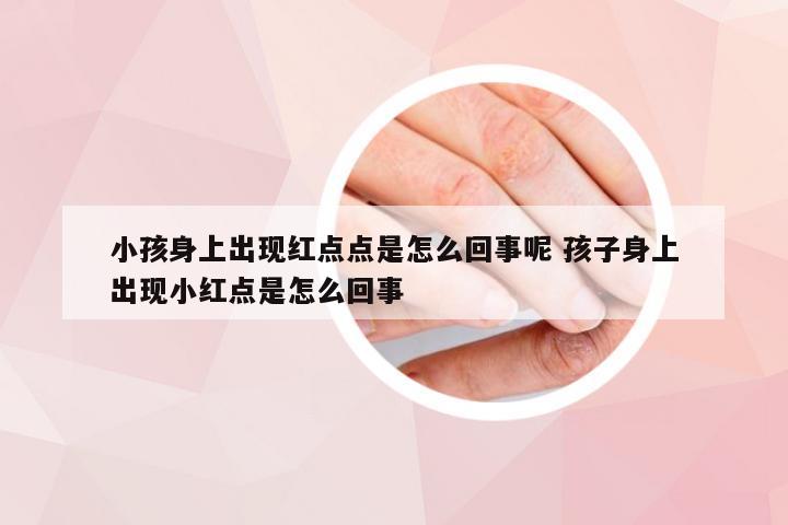 小孩身上出现红点点是怎么回事呢 孩子身上出现小红点是怎么回事