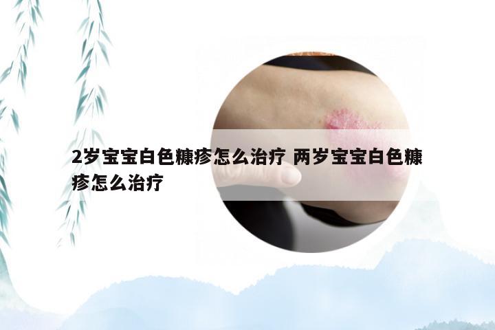 2岁宝宝白色糠疹怎么治疗 两岁宝宝白色糠疹怎么治疗