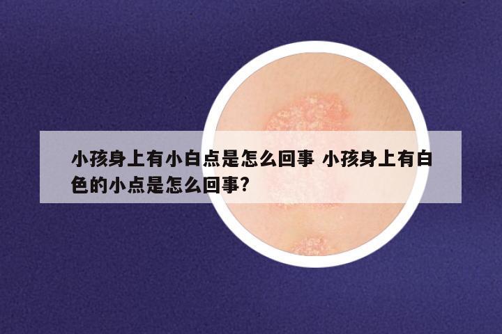 小孩身上有小白点是怎么回事 小孩身上有白色的小点是怎么回事?