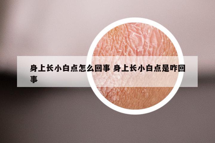 身上长小白点怎么回事 身上长小白点是咋回事