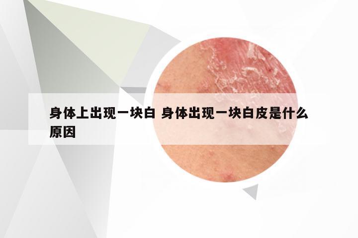 身体上出现一块白 身体出现一块白皮是什么原因