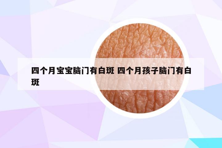 四个月宝宝脑门有白斑 四个月孩子脑门有白斑