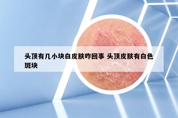 头顶有几小块白皮肤咋回事 头顶皮肤有白色斑块