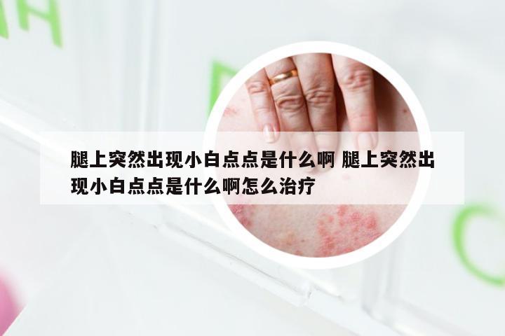腿上突然出现小白点点是什么啊 腿上突然出现小白点点是什么啊怎么治疗