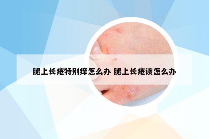 腿上长疮特别痒怎么办 腿上长疮该怎么办