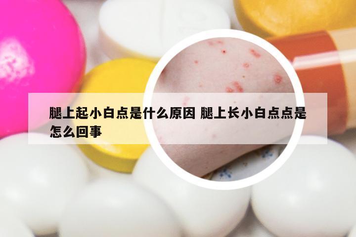 腿上起小白点是什么原因 腿上长小白点点是怎么回事
