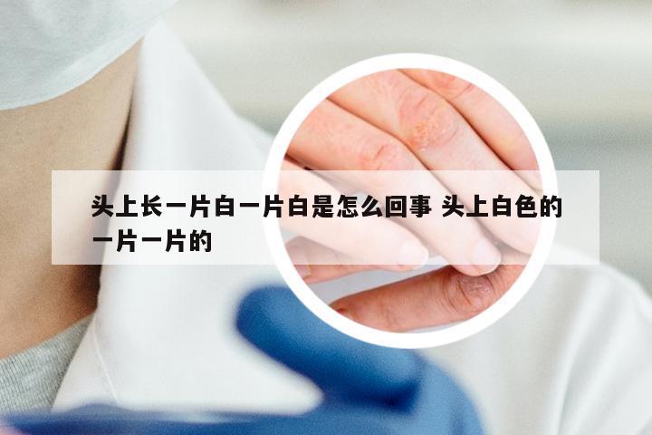 头上长一片白一片白是怎么回事 头上白色的一片一片的