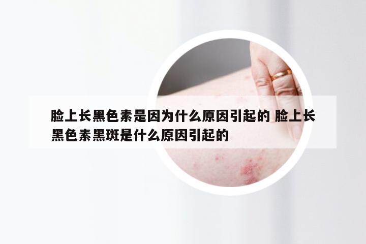 脸上长黑色素是因为什么原因引起的 脸上长黑色素黑斑是什么原因引起的