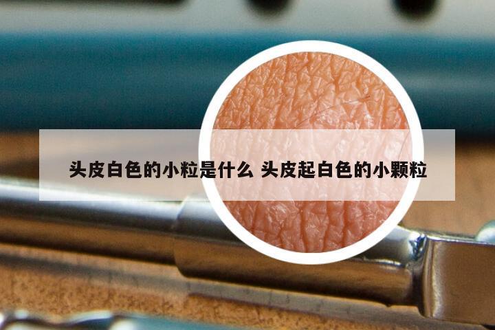 头皮白色的小粒是什么 头皮起白色的小颗粒