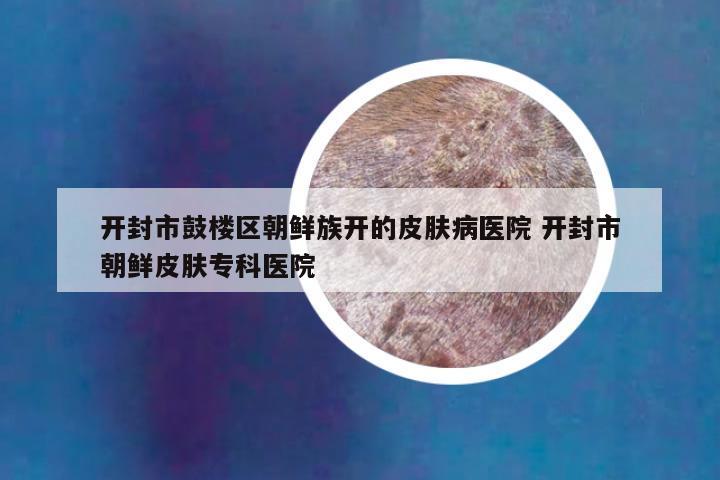 开封市鼓楼区朝鲜族开的皮肤病医院 开封市朝鲜皮肤专科医院