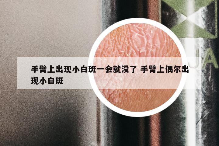 手臂上出现小白斑一会就没了 手臂上偶尔出现小白斑