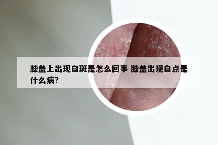 膝盖上出现白斑是怎么回事 膝盖出现白点是什么病?