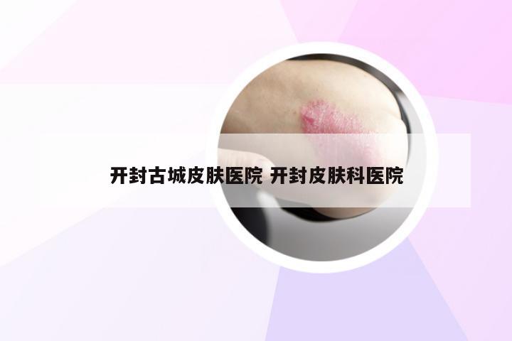 开封古城皮肤医院 开封皮肤科医院