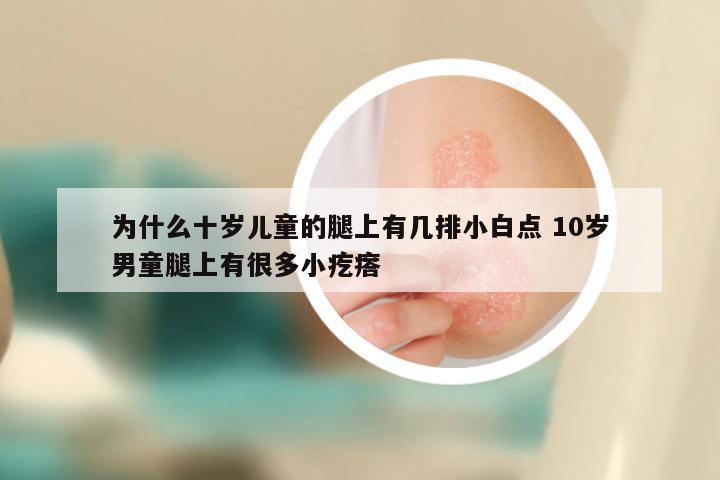 为什么十岁儿童的腿上有几排小白点 10岁男童腿上有很多小疙瘩