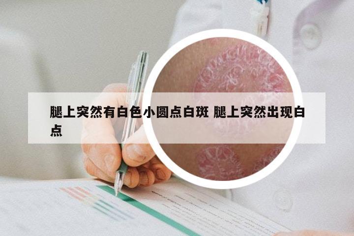 腿上突然有白色小圆点白斑 腿上突然出现白点