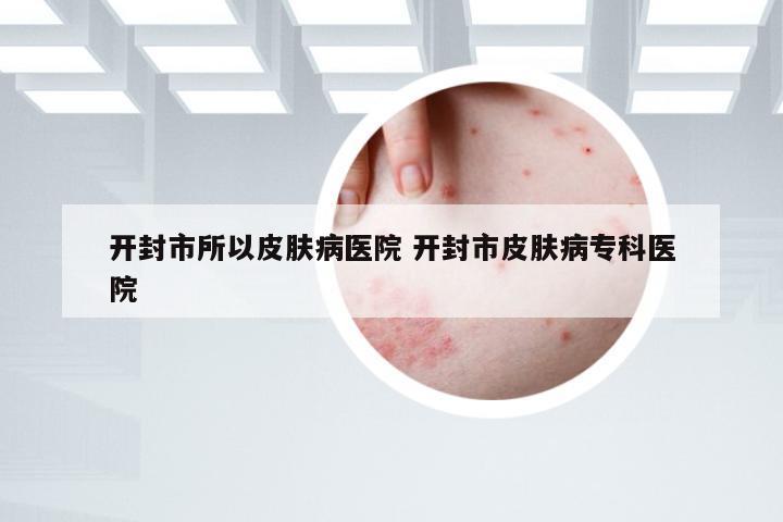 开封市所以皮肤病医院 开封市皮肤病专科医院