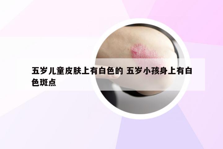 五岁儿童皮肤上有白色的 五岁小孩身上有白色斑点