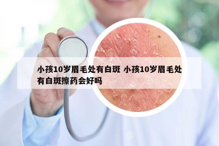小孩10岁眉毛处有白斑 小孩10岁眉毛处有白斑擦药会好吗