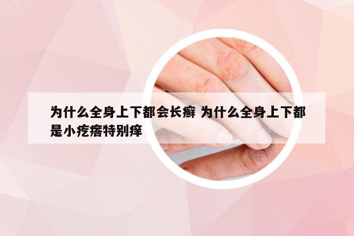 为什么全身上下都会长癣 为什么全身上下都是小疙瘩特别痒