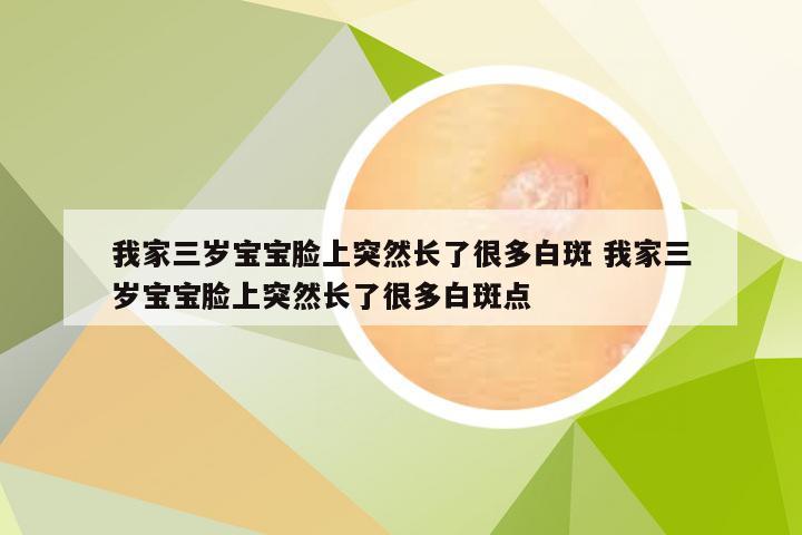 我家三岁宝宝脸上突然长了很多白斑 我家三岁宝宝脸上突然长了很多白斑点