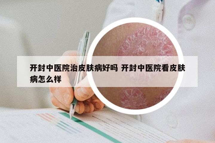 开封中医院治皮肤病好吗 开封中医院看皮肤病怎么样