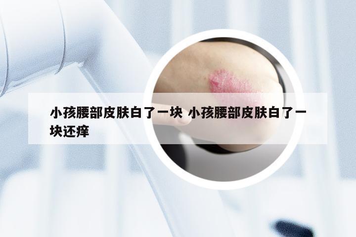 小孩腰部皮肤白了一块 小孩腰部皮肤白了一块还痒
