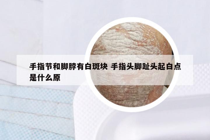 手指节和脚脖有白斑块 手指头脚趾头起白点是什么原