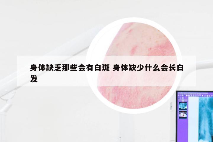 身体缺乏那些会有白斑 身体缺少什么会长白发