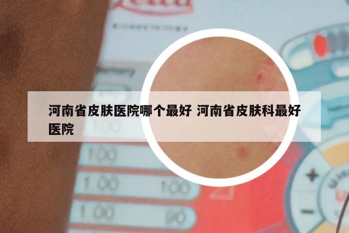 河南省皮肤医院哪个最好 河南省皮肤科最好医院