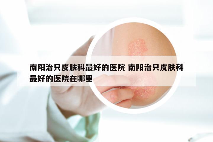 南阳治只皮肤科最好的医院 南阳治只皮肤科最好的医院在哪里