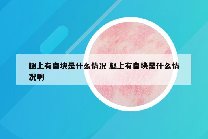 腿上有白块是什么情况 腿上有白块是什么情况啊
