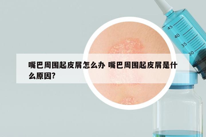 嘴巴周围起皮屑怎么办 嘴巴周围起皮屑是什么原因?