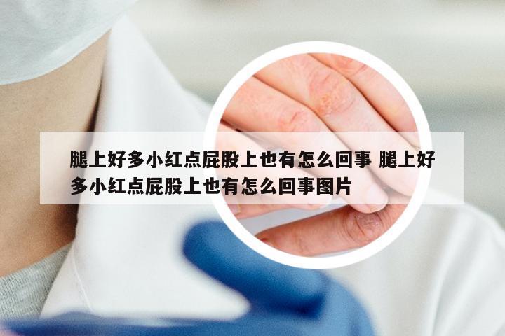 腿上好多小红点屁股上也有怎么回事 腿上好多小红点屁股上也有怎么回事图片