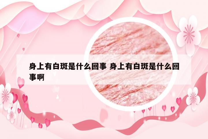 身上有白斑是什么回事 身上有白斑是什么回事啊