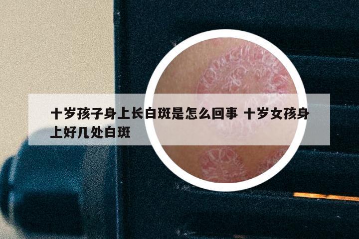 十岁孩子身上长白斑是怎么回事 十岁女孩身上好几处白斑